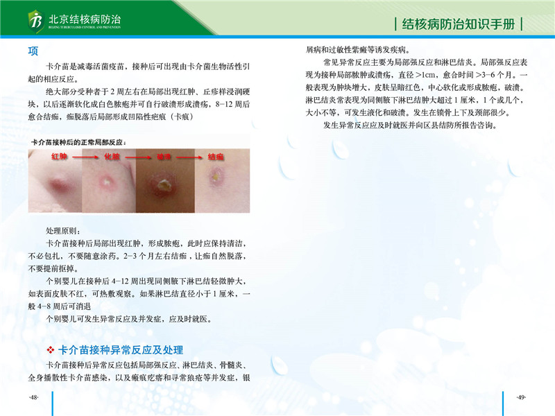防治知识手册-28.jpg