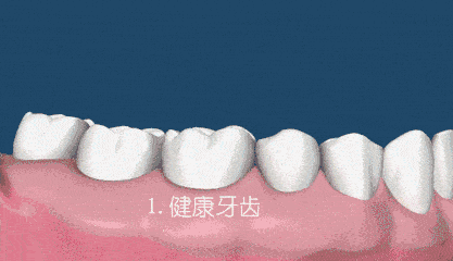 3.gif