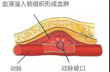 微信图片_20210927143107.jpg 微信图片_20210927143107.jpg
